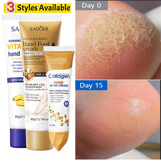 Anti Crack Hand Foot Cream Anti-Drying Heel Cracked Repair Feet Mask Removal Dead Skin Moisturizing Whitening Feet Care Products hand and feet