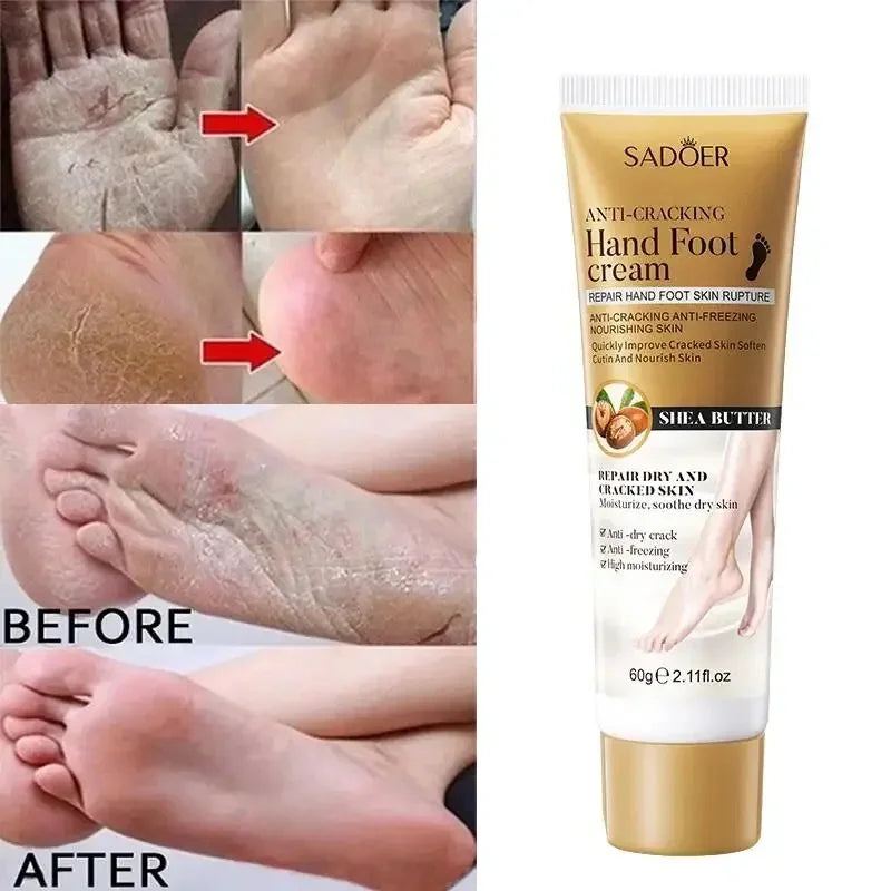 Anti Crack Hand Foot Cream Anti-Drying Heel Cracked Repair Feet Mask Removal Dead Skin Moisturizing Whitening Feet Care Products hand and feet