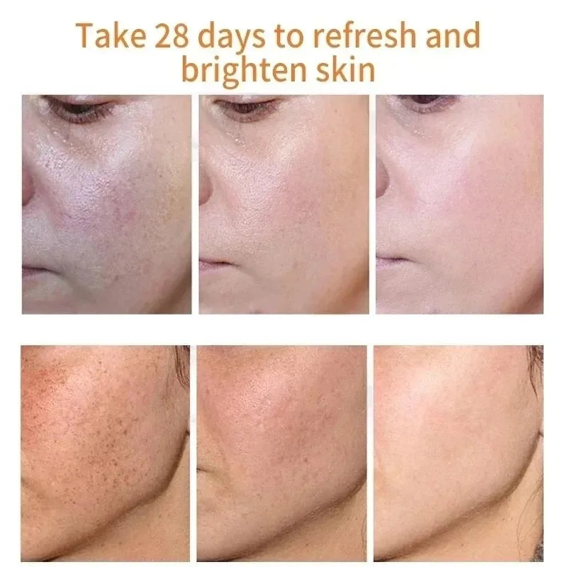 Fades Freckle Dark Spots Face Cream Niacinamide Whitening Cream Vitamin E Improve Dullness Fast Brighten Nourish Skin Care face care