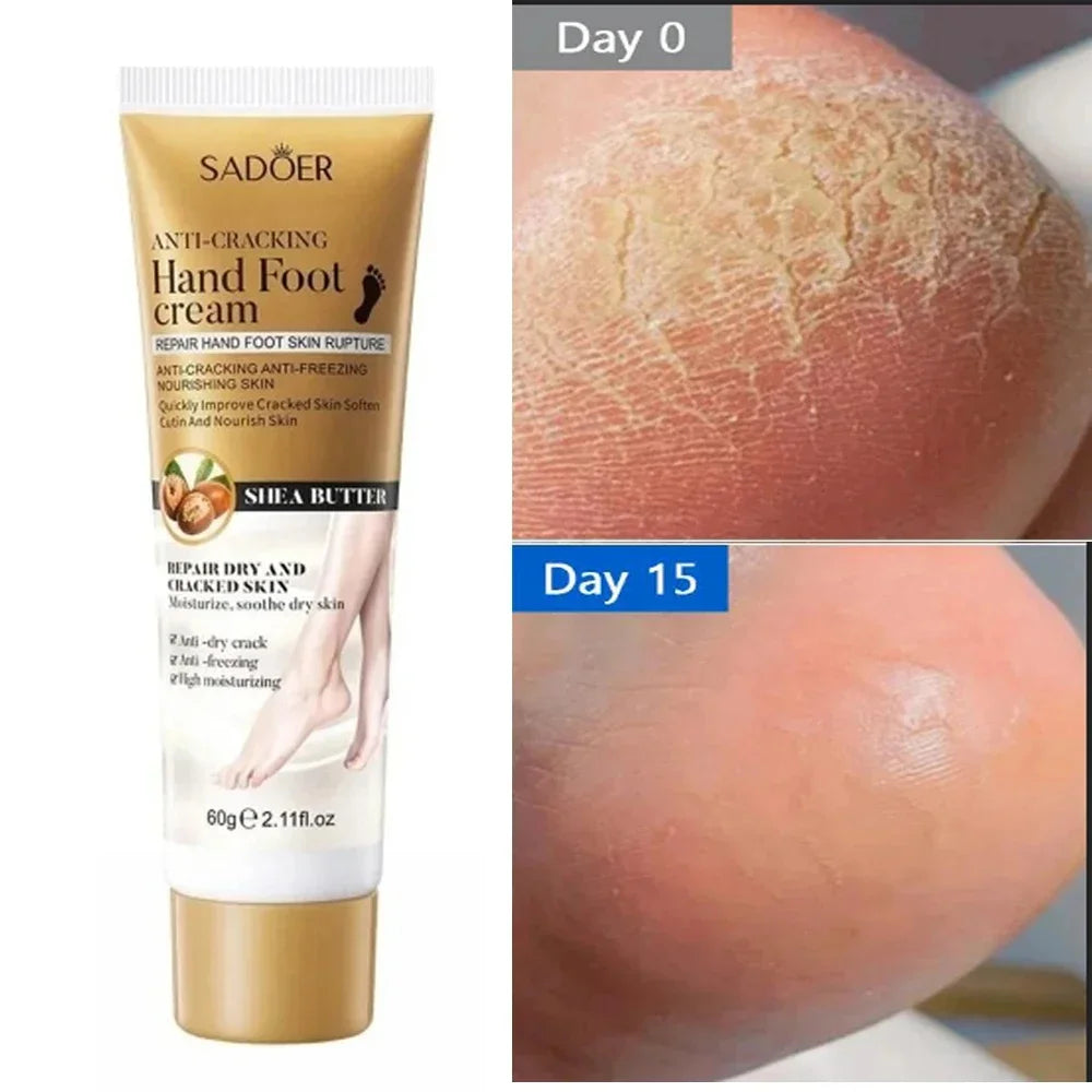 Anti Crack Hand Foot Cream Anti-Drying Heel Cracked Repair Feet Mask Removal Dead Skin Moisturizing Whitening Feet Care Products hand and feet