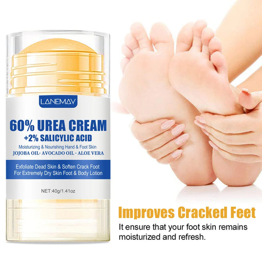 60% Urea Foot Cream Ultra-hydrating Aloe Vera Nourishing Hand Foot Skin Softening Dry Cracked Feet Gentle Exfoliation Peeling hand and feet