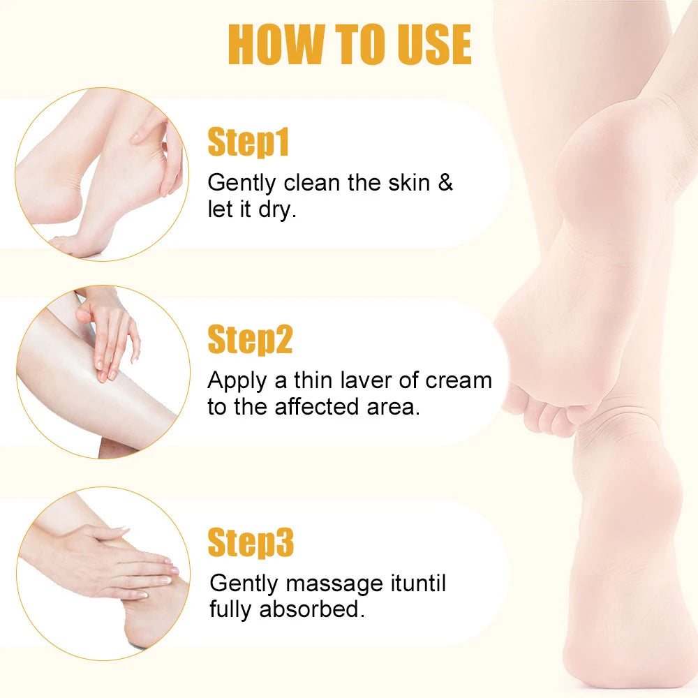 60% Urea Foot Cream Ultra-hydrating Aloe Vera Nourishing Hand Foot Skin Softening Dry Cracked Feet Gentle Exfoliation Peeling hand and feet