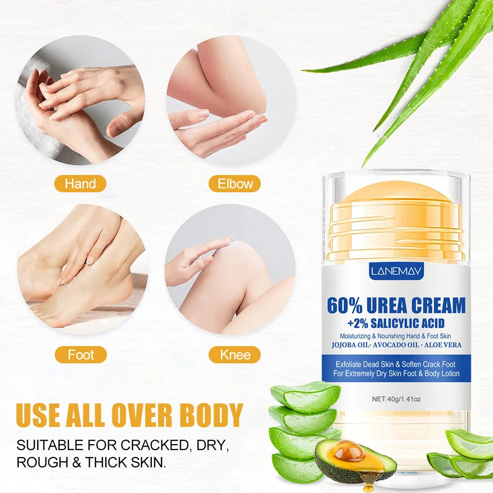 60% Urea Foot Cream Ultra-hydrating Aloe Vera Nourishing Hand Foot Skin Softening Dry Cracked Feet Gentle Exfoliation Peeling hand and feet