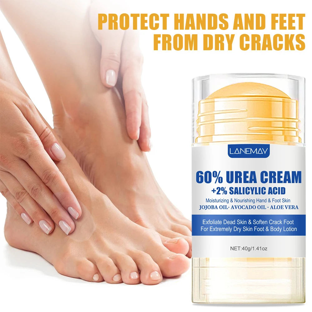 60% Urea Foot Cream Ultra-hydrating Aloe Vera Nourishing Hand Foot Skin Softening Dry Cracked Feet Gentle Exfoliation Peeling hand and feet