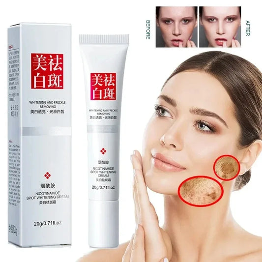 Fades Freckle Dark Spots Face Cream Niacinamide Whitening Cream Vitamin E Improve Dullness Fast Brighten Nourish Skin Care face care