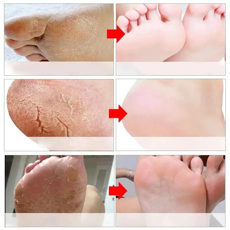 Anti Crack Hand Foot Cream Anti-Drying Heel Cracked Repair Feet Mask Removal Dead Skin Moisturizing Whitening Feet Care Products hand and feet